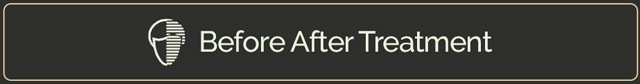 Before After